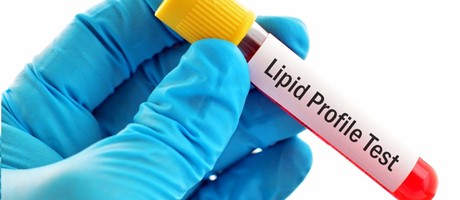 What Is Lipid Profile?