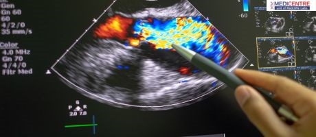 A Comprehensive Guide to Color Doppler Ultrasound