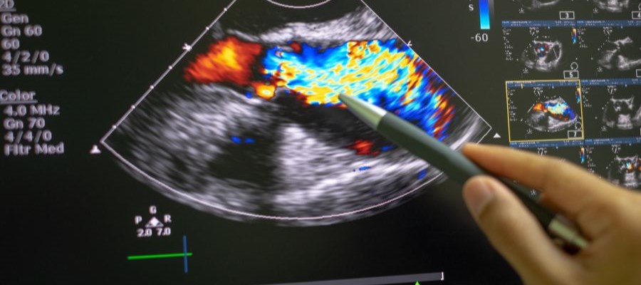 A Comprehensive Guide to Color Doppler Ultrasound