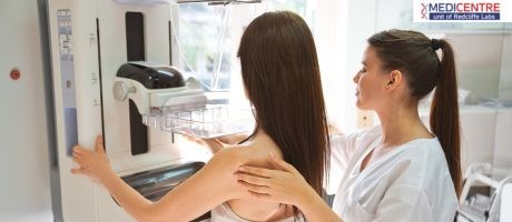 Mammography: A Comprehensive Guide to Breast Cancer Detection and Prevention