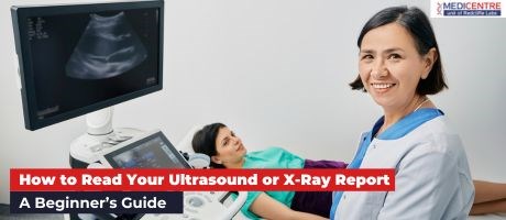 How to Read Your Ultrasound or X-Ray Report: A Beginner’s Guide