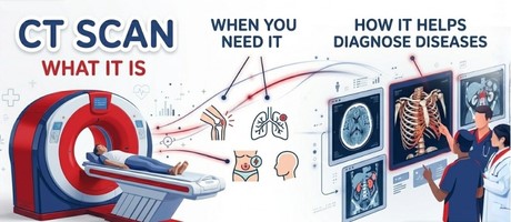 CT Scan: What It Is, When You Need It & How It Helps Diagnose Diseases